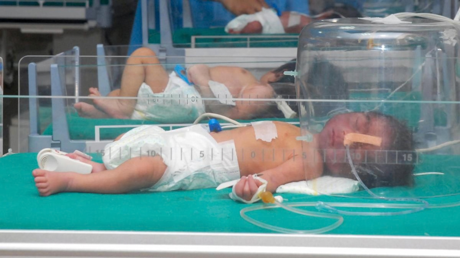Surfactant is used to support lung function in some very premature babies whose lungs have not produced enough natural surfactant.