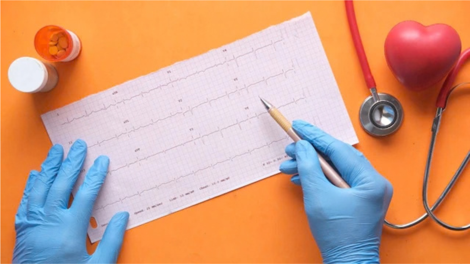 Bradycardia: When a Slow Heartbeat Needs Attention
