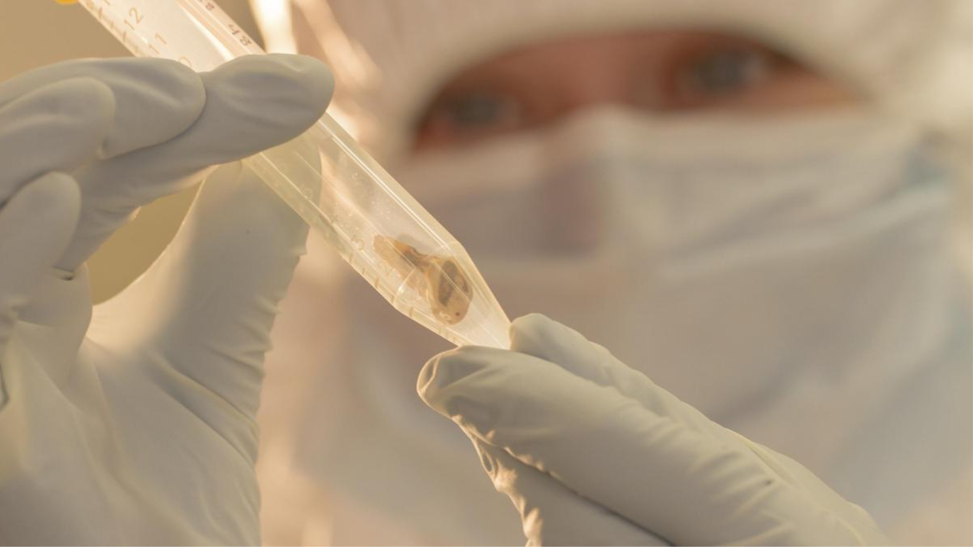 Russian authorities are monitoring contacts after a worker at a Siberian plague research institute died from pneumonia of unknown origin.