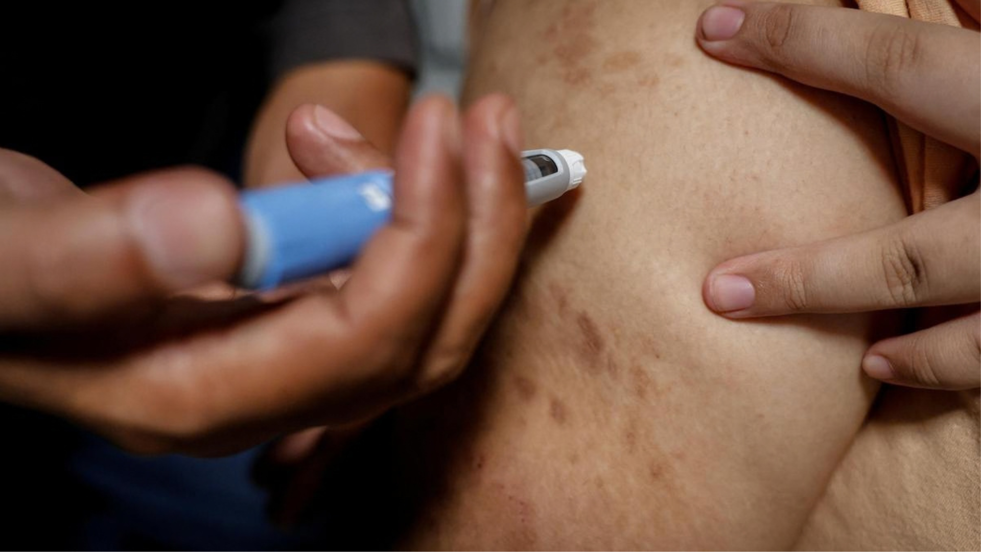 WHO Advises Against Obesity Drugs, Surgery for Under-10s