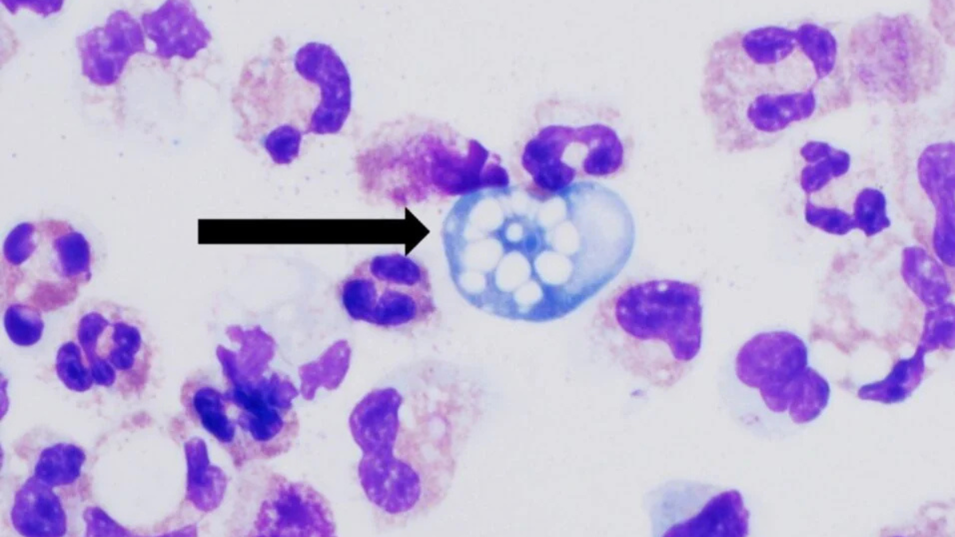 Scientists Identify Promising Compound Against Brain-Eating Amoeba in Lab Tests